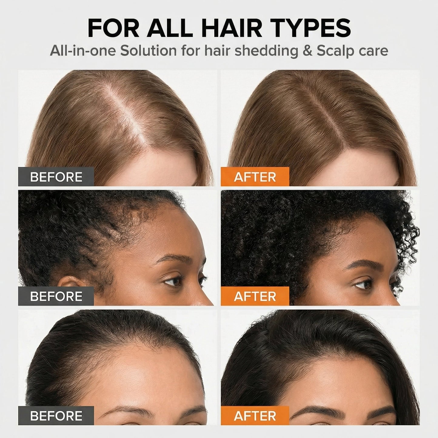 LunaLee™ Thickening Hair Growth Serum Brush