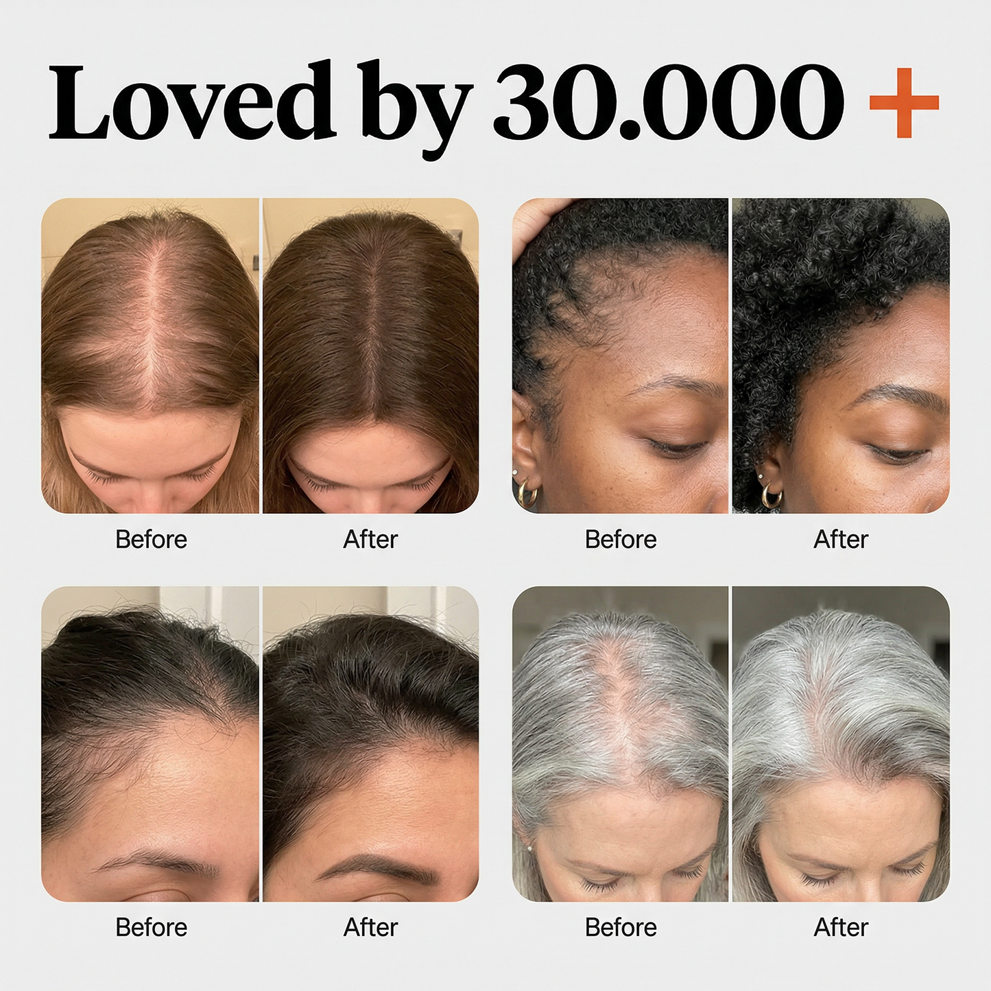 LunaLee™ Thickening Hair Growth Serum Brush